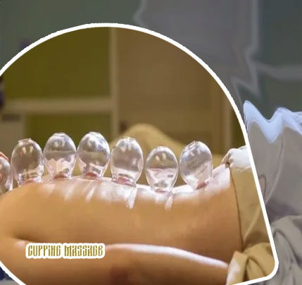 Cupping and massage near me